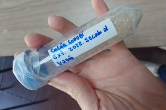 colágeno de la piel de surubí